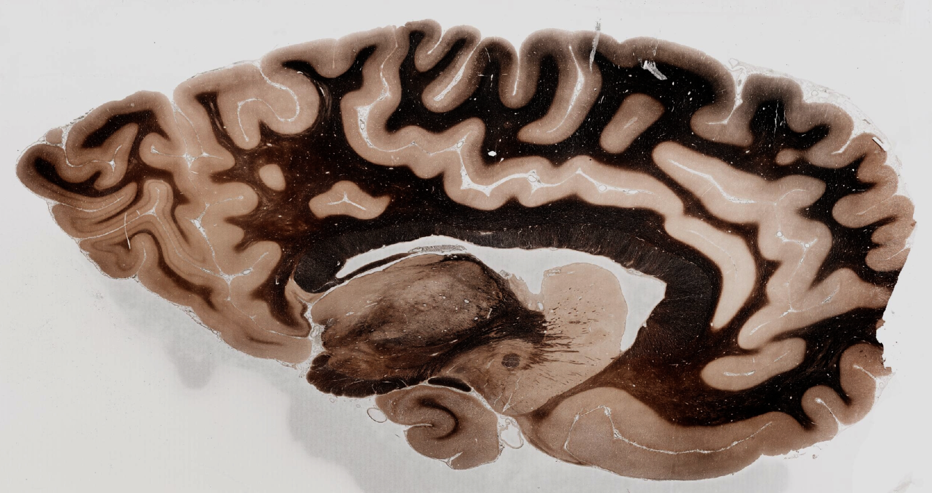 Adult Human Brain Myelin Stain